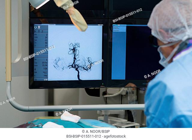 Reportage in the interventional neuroradiology service in Pasteur 2 Hospital, Nice, France. Emergency treatment of an ischemic stroke through thrombectomy
