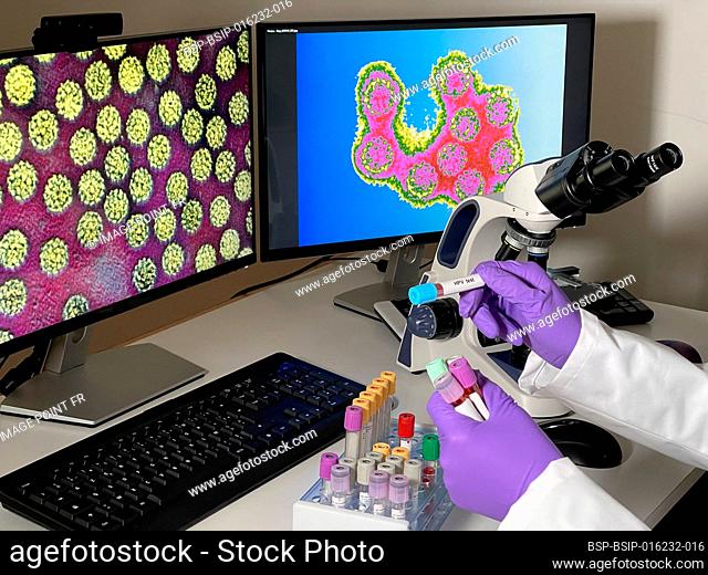 Laboratory assistant doing research with papillomavirus images on a computer