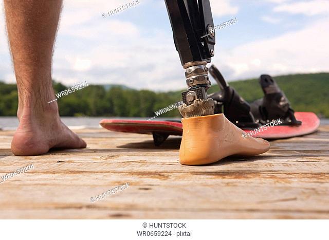Athlete with an artificial leg with a water ski board on a dock