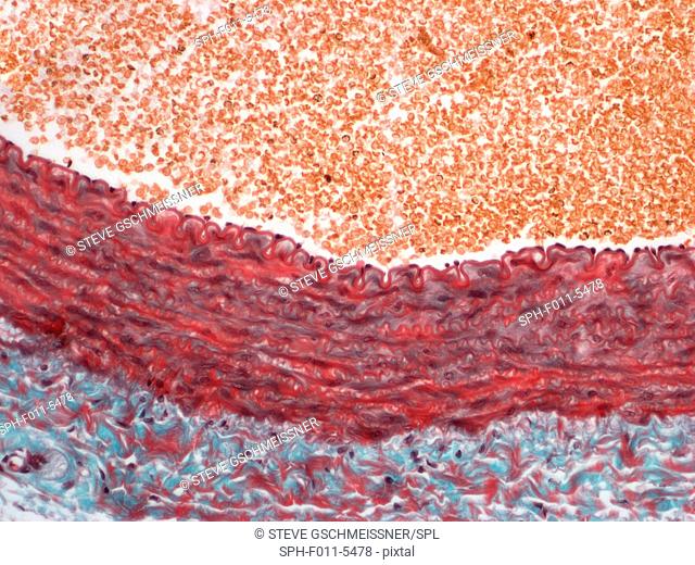 Artery. Light micrograph of a section of a muscular artery. This is the most common type among arteries. Starting innermost the artery wall is formed by an...