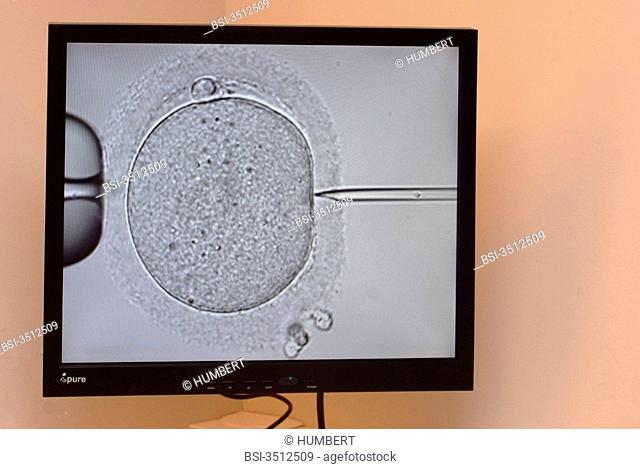 Photo essay in a medically assisted procreation centre at the Pierre Rouques hospital 'Les Bluets', Paris, France. Biology laboratory. IVF by ICSI