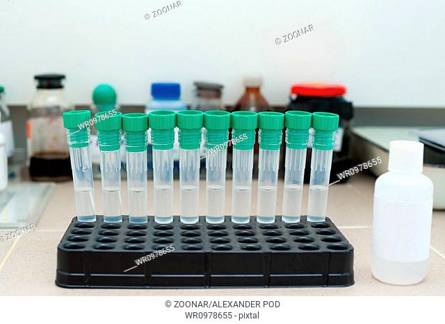 test tubes at clinic laboratory