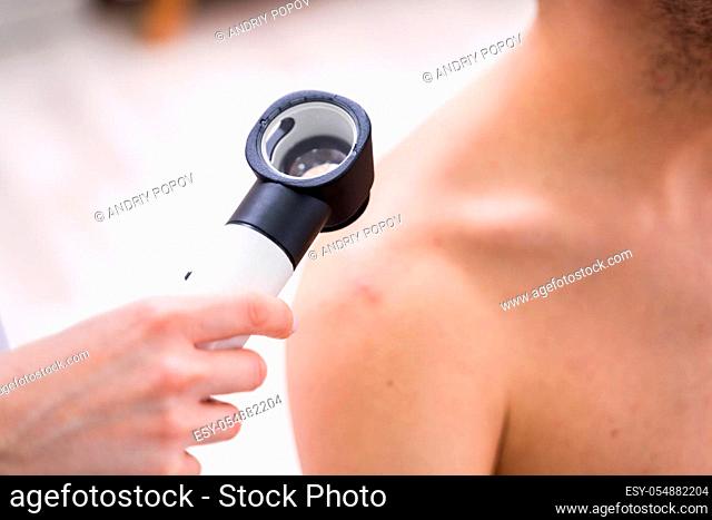Close-up Of Person Hands Examining Acne Skin Of Man With Dermatoscope