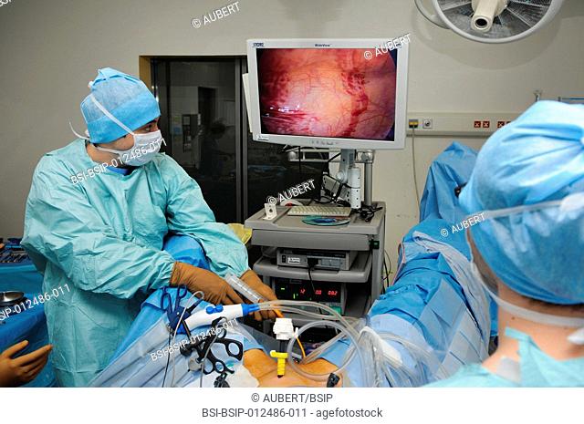 Photo essay at Lyon hospital, France. Department of urology. Sex reassignment sugery transgender FtM. Here hystero-ovariectomy under laparoscopy