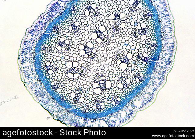 Asparagus stem cross section showing cuticle, epidermis, stomata, palisade parenchyma, sclerenchyma and vascular bundles. Monocot stem photomicrograph