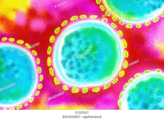 HANTAVIRUS<BR>The hantavirus causes Korean hemorrhagic fever (fever and kidney failure). TEM
