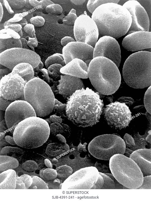A scanning electron microsope's view of blood cells. The round non-nucleated doughnut shaped cells are red blood cells, which transport oxygen and remove carbon...