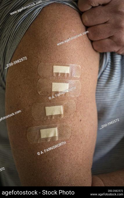A man's arm with four bandaids, representing four innoculations, including a booster shot