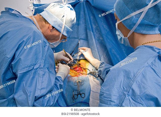 Photo essay from hospital. Photo essay at Alleray-Labrouste clinic, Paris, France. Department of vascular surgery. Operating room