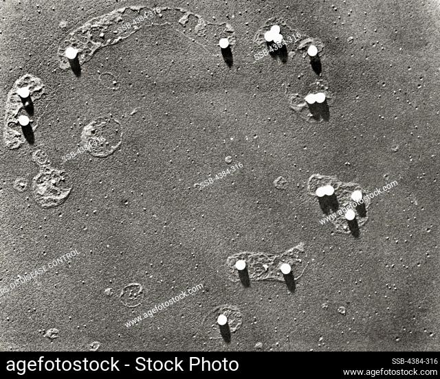 Scanning Electron Photomicrograph of Polio Virions