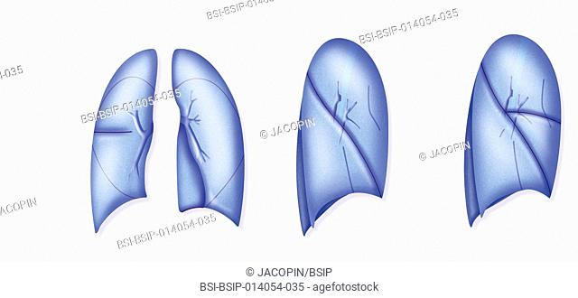 Lung, drawing