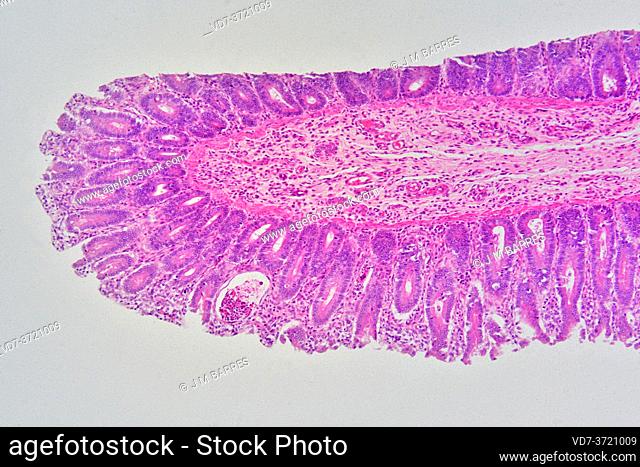 Human rectum with mucosa, intestinal glands, lamina propria and submucosa. X75 at 10 cm wide