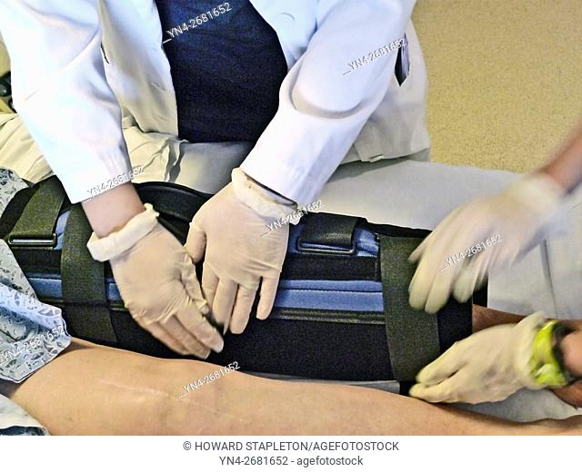 A compression therapy leg brace is fitted to a hospital patient following knee surgery. It is used in hospitals for the prevention of DVT or Deep Vein...