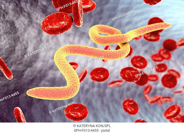 Microfilaria worms in blood. Computer illustration showing immature filarial worms (microfilaria), the cause of filariasis