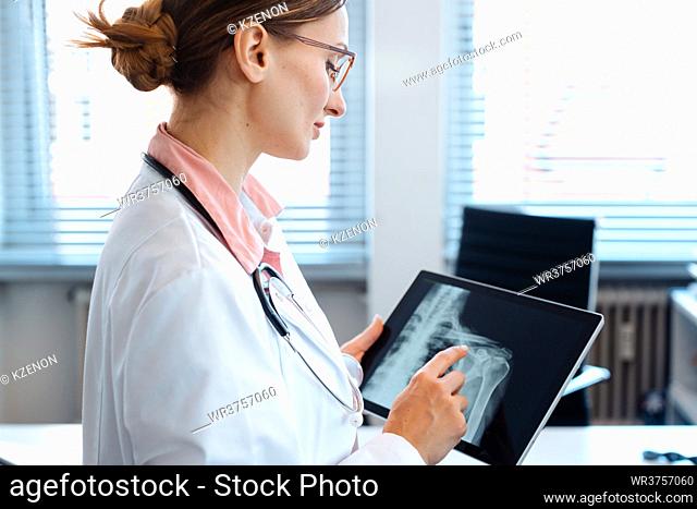 Doctor looking at x-ray picture of a shoulder on her modern tablet computer