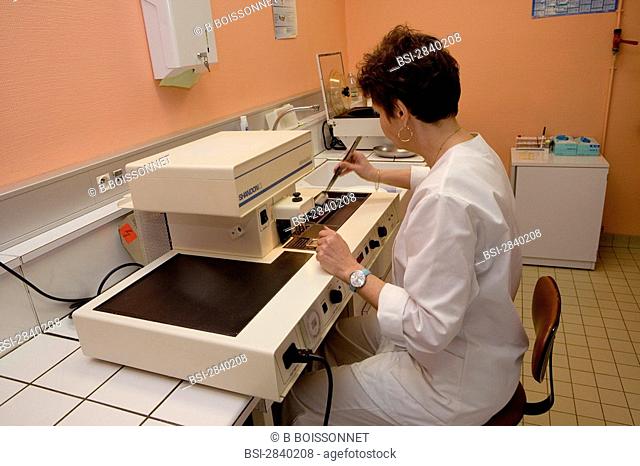 Photo essay from hospital. Photo essay from hospital. Hospital of Meaux 77, France. Laboratory of anatomical pathology. Device to embed the samples into the...