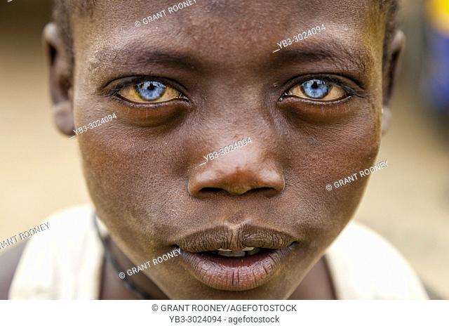 A Young African Boy With Blue Eyes, Jinka, Omo Valley, Ethiopia