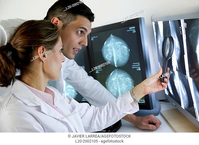 Image report. Mammogram, Mammography. Breast Cancer. Onkologikoa Hospital, Oncology Institute, Case Center for prevention, diagnosis and treatment of cancer