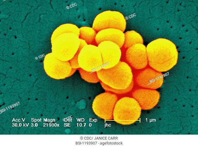 MICROCOCCUS LUTEUS Micrococcus luteus, scanning electron micrograph colorized SEM, x 21 930, the line represents 1 micron Micrococcus luteus is Gram-positive...