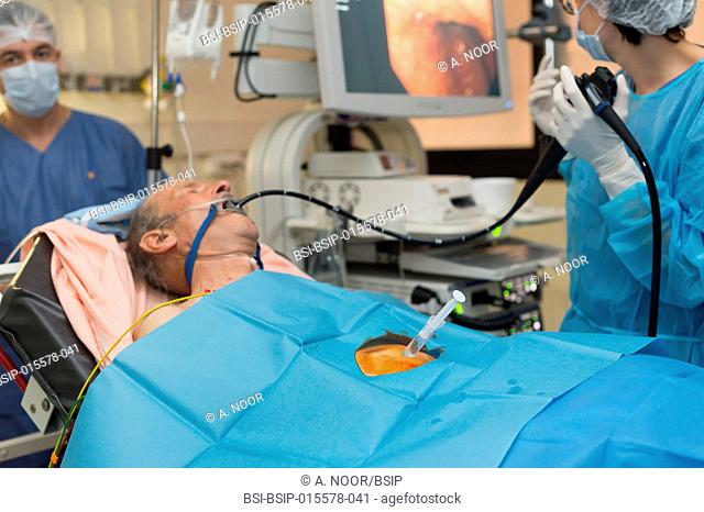 Reportage in the hepatology service of Archet Hospital, Nice, France. A gastrostomy, a procedure enabling the installation of parenteral nutrition