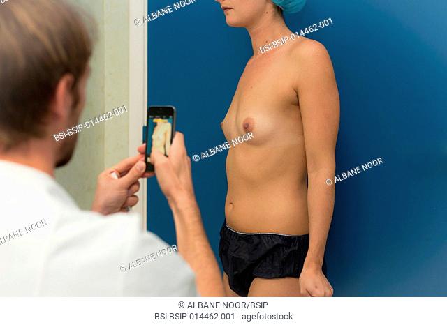 Reportage at the Mozart Plastic Surgery clinic in Nice, France. Insertion of breast implants, via the armpit, in a patient who has no mammary glands