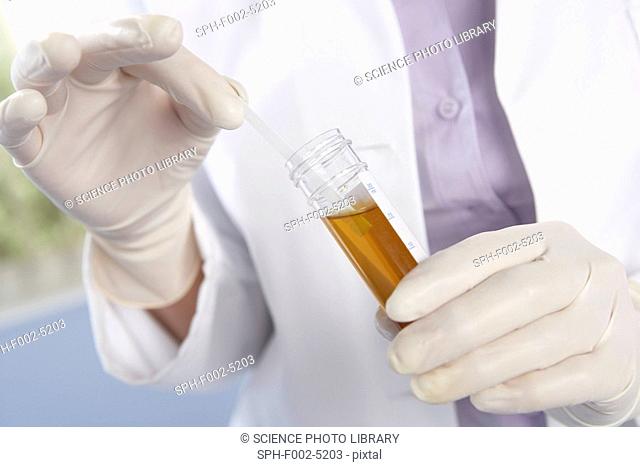 Urine sample analysis