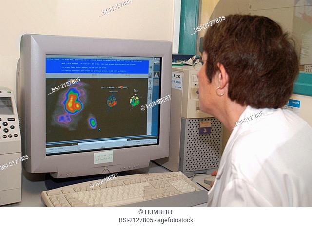 SCINTISCANNER<BR>Private hospital in Antony, France.<BR>Department of  nuclear medicine. Scintiscanning of the left cardiac cavity