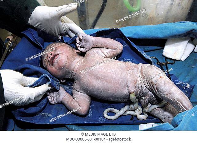 New born baby in cot, soon after birth umbilical cord still attached
