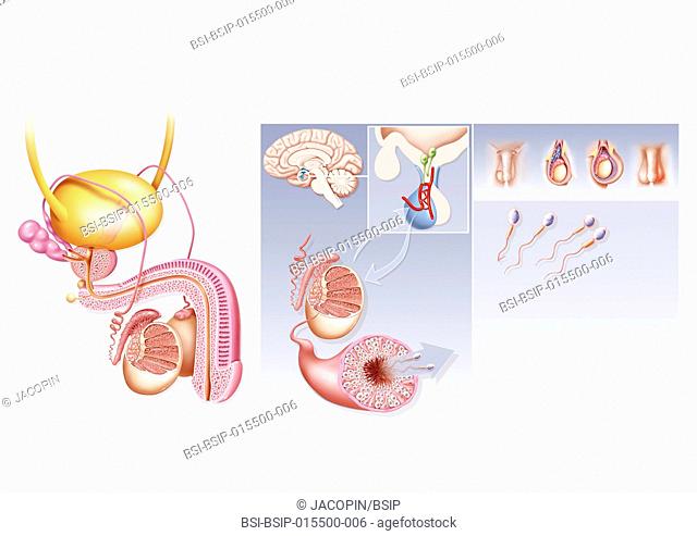 Illustration of the causes of male infertility. On the left, illustration of the male genital organs. In the centre, illustration of the...