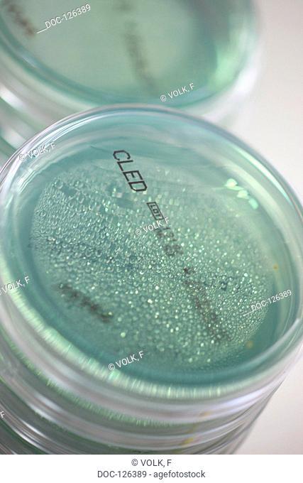 petri dish Microbiological culture