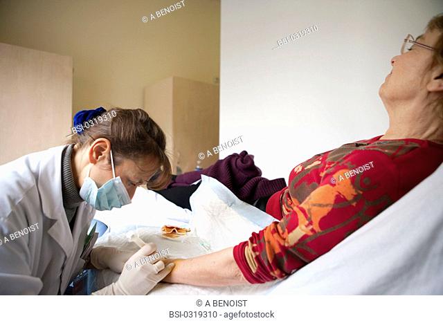 Photo essay in rheumatology at La Croix Saint-Simon Hospital, Paris, France. Treatment of a wrist synovitis in a patient suffering from hand polyrheumatoid...