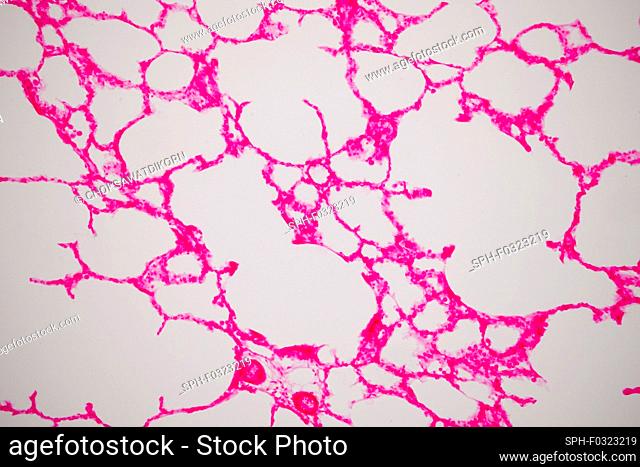Human lung tissue, light micrograph