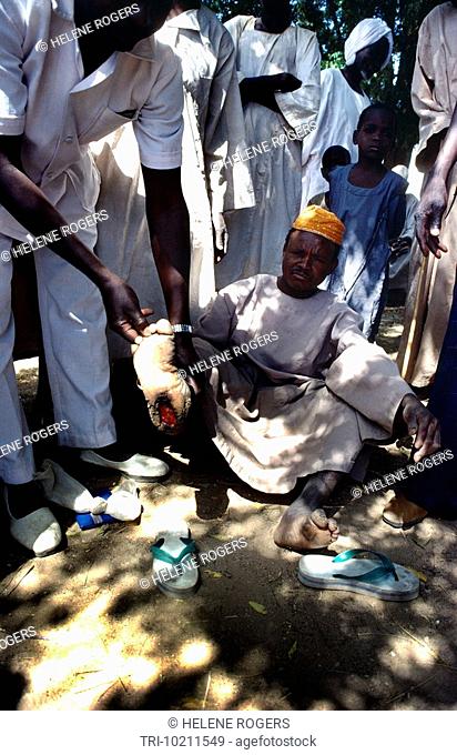 El Geneina Sudan Nurse Tending Lepers To Clean Wound Soap & Water