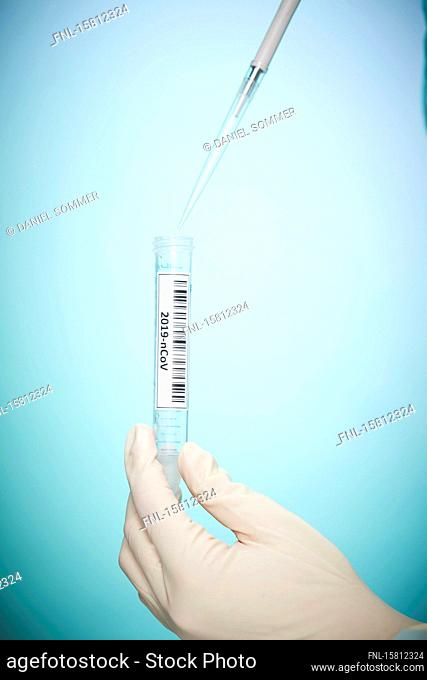 Female hands hold corona virus sample in test tube