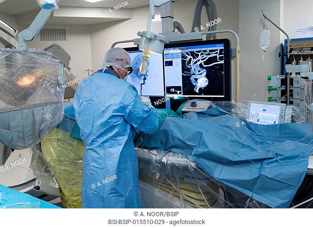 Reportage in the interventional neuroradiology service in Pasteur 2 Hospital, Nice, France. Treating a cerebral aneurysm through embolization