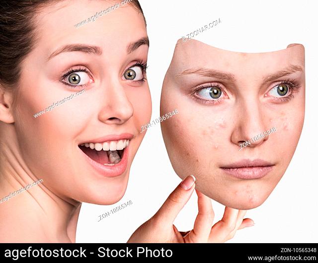 Young woman puts away mask with bad acne skin over white background