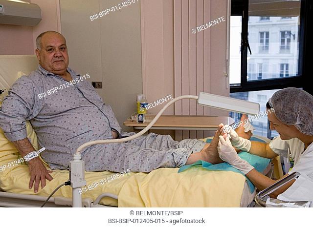 Photo essay in the department of diabetology at Saint-Louis hospital, Paris, France. A nurse caring the diabetic foot ulcer
