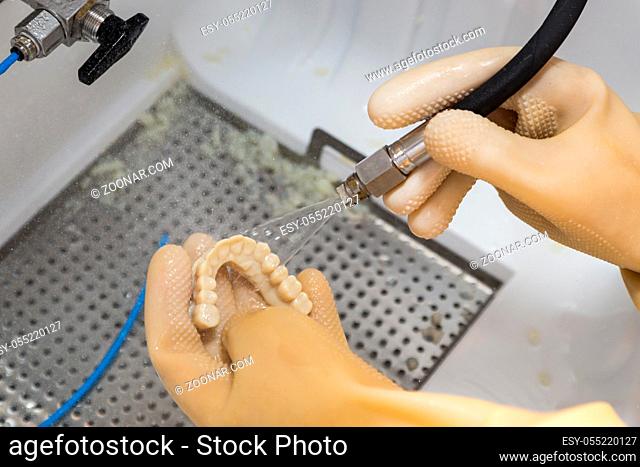 Dental Technician Cleans 3D Printed Dental Implant Bridge In Lab With Water