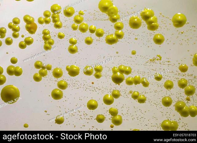 Bacteria grown from skin smear, colonies of Micrococcus luteus and Staphylococcus epidermidis on Petri dish with nutrient agar, closeup view