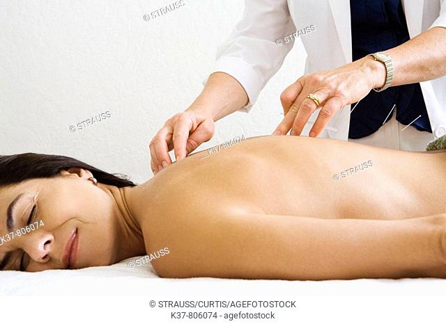 Woman having acupuncture therapy