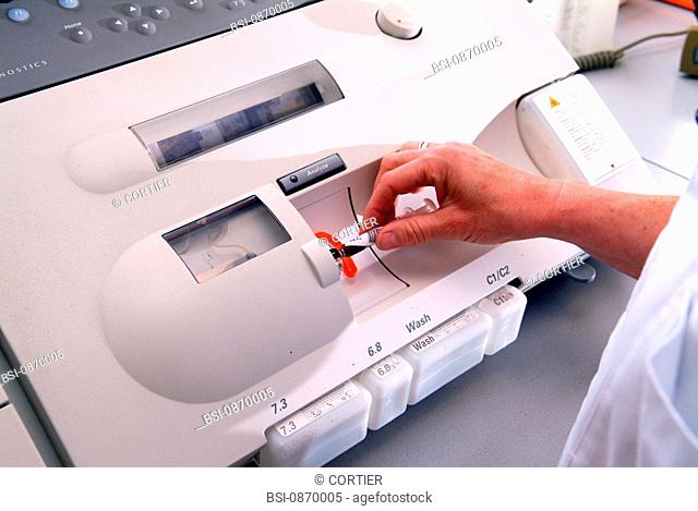 BLOOD ANALYSIS<BR>Photo essay from hospital.<BR>Analytical laboratory. Arterial blood gas analysis (ABG) measures the amounts of oxygen and carbon dioxide in...