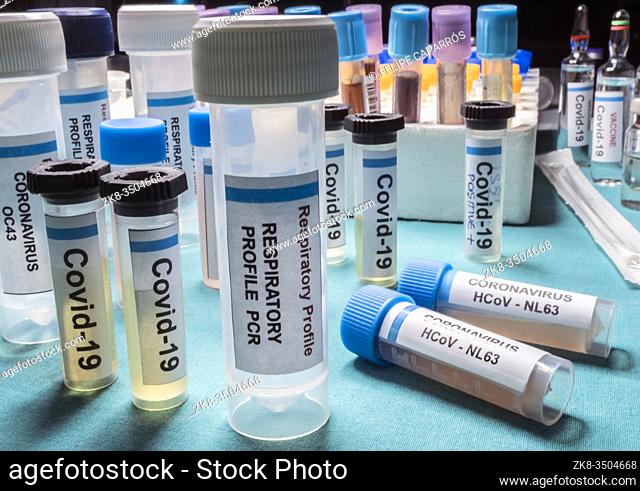 Vials containing samples from patients infected with covid19 coronavirus in a laboratory, Spain