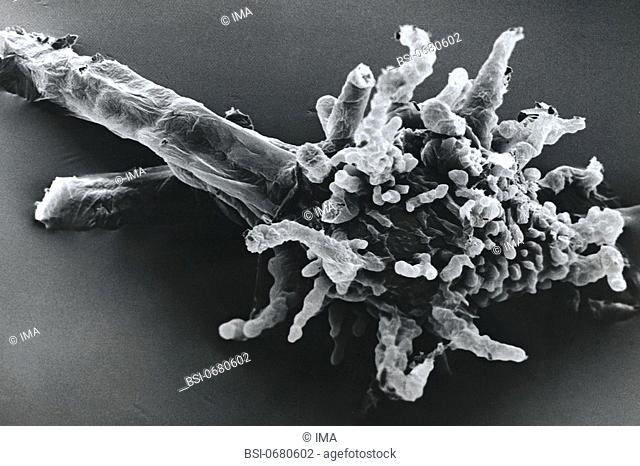AMEBA<BR>Amoeba proteus, viewed under SEM