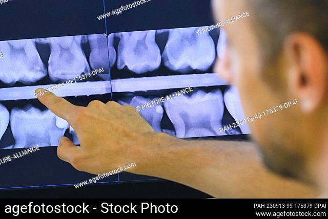 PRODUCTION - 11 September 2023, Lower Saxony, Hanover: A pediatric dentist views an X-ray of a child's deciduous molars in a pediatric dental office
