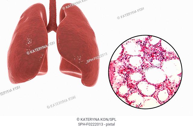 Human lungs anatomy and histology, illustration