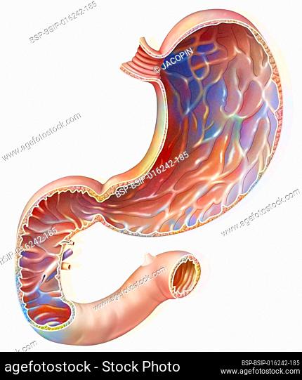 Section of the stomach and duodenum with the gastric mucosa