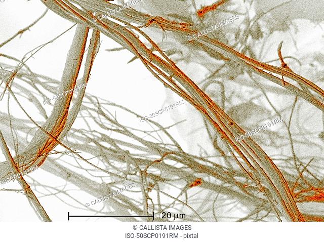 Scanning Electron micrograph of asbestos, 1500x