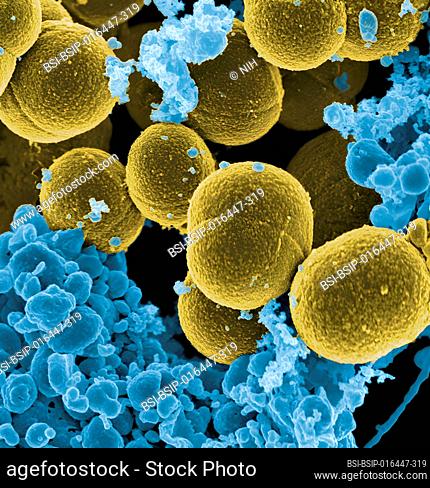 Scanning electron micrograph of S. aureus bacteria escaping destruction by human white blood cells