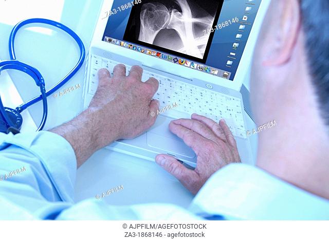 X-ray diagnosis  Doctor typing up the results of a patient's shoulder X-ray