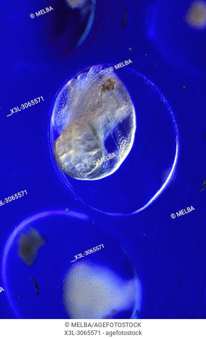 Snail eggs. Physella sp. Gastropodos. Mollusca. Optic microscopy